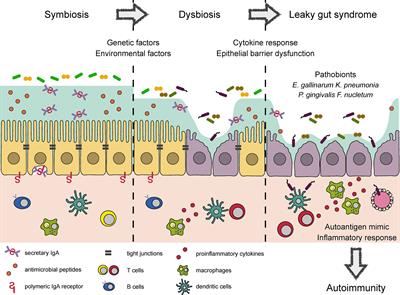 Partners in Leaky Gut Syndrome: Intestinal Dysbiosis and Autoimmunity